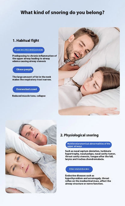 JianYouCare EMS Pulse Stop Snore Portable Electric Anti-snoring Device Well Stop Snore Health Care Sleep Aid Breathing Corrector